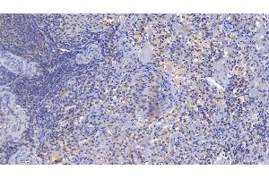 Detection of CR1 in Human Spleen Tissue using Polyclonal Antibody to Complement Receptor 1, Erythrocyte (CR1) (CD35 anticorps  (AA 1780-2039))