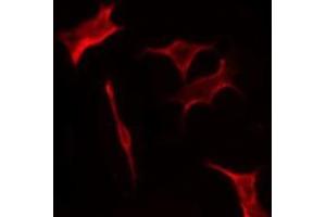 ABIN6276140 staining HuvEc by IF/ICC.