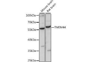 Western blot analysis of extracts of various cell lines, using TMEM44 antibody (ABIN7270964) at 1:1000 dilution. (TMEM44 anticorps  (AA 110-260))