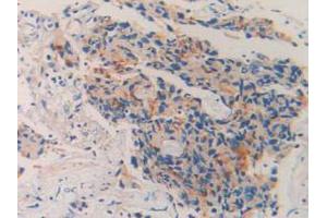 IHC-P analysis of Human Prostate Gland Tissue, with DAB staining. (MME anticorps  (AA 382-538))