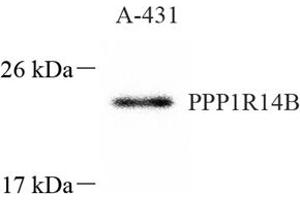 Western blot analysis of PNG (ABIN7075269),at dilution of 1: 1000 (PPP1R14B anticorps)