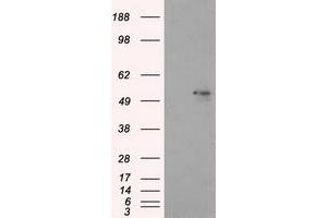 Image no. 6 for anti-Aldehyde Dehydrogenase 3 Family, Member A1 (ALDH3A1) antibody (ABIN1496591) (ALDH3A1 anticorps)