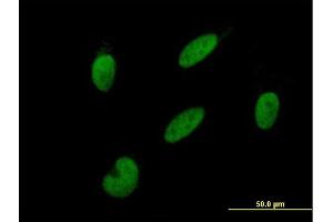 Immunofluorescence of purified MaxPab antibody to GTF2A2 on HepG2 cell. (GTF2A2 anticorps  (AA 1-109))