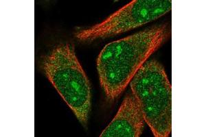 Immunofluorescent staining of RH-30 cells with ARPP-21 polyclonal antibody  (Green) shows localization to nucleoli and cytosol. (ARPP21 anticorps)