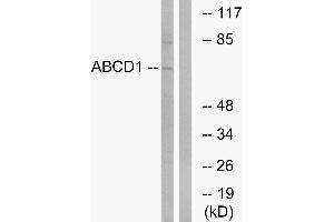 Western blot analysis of extracts from Jurkat cells, using ABCD1 antibody. (ABCD1 anticorps)