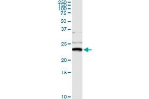 Immunoprecipitation of NME1 transfected lysate using anti-NME1 monoclonal antibody and Protein A Magnetic Bead , and immunoblotted with NME1 MaxPab rabbit polyclonal antibody.