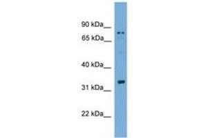 Image no. 1 for anti-Sperm Acrosome Associated 1 (SPACA1) (AA 51-100) antibody (ABIN6745571) (SPACA1 anticorps  (AA 51-100))