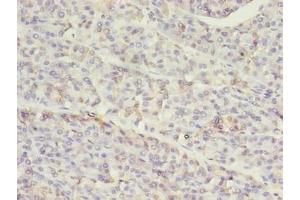 Immunohistochemistry of paraffin-embedded human pancreatic tissue using ABIN7155517 at dilution of 1:100 (SETD7 anticorps  (AA 1-218))