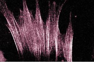 Immunofluorescence staining of human fibroblasts. (ARHGAP5 anticorps  (AA 1102-1214))