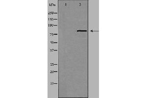 Western blot analysis of extracts from HeLa cells, using UTP14A antibody. (UTP14A anticorps  (N-Term))
