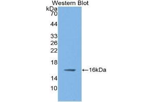 WB of Protein Standard: different control antibodies against Highly purified E.