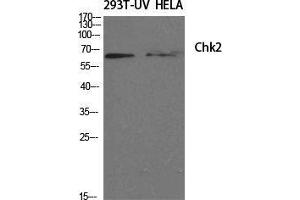 Western Blot (WB) analysis of specific cells using Chk2 Polyclonal Antibody.