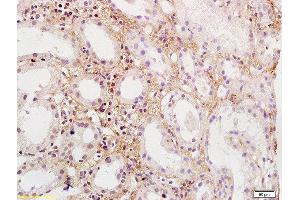 Formalin-fixed and paraffin embedded human kidney labeled with Rabbit Anti-PDGFBB Polyclonal Antibody, Unconjugated  at 1:200 followed by conjugation to the secondary antibody and DAB staining (PDGF-BB Homodimer (AA 151-241) anticorps)
