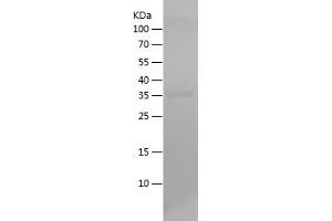 Western Blotting (WB) image for Heat Shock 10kDa Protein 1 (Chaperonin 10) (HSPE1) (AA 1-102) protein (His-IF2DI Tag) (ABIN7123260)