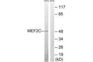 Western blot analysis of extracts from 3T3 cells, treated with starved (24hours), using MEF2C (Ab-396) antibody. (MEF2C anticorps  (Ser396))