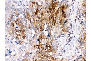 IHC analysis of DARPP32 using anti-DARPP32 antibody (ABIN3044534).