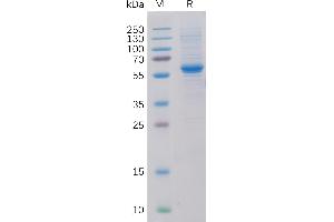 Human Protein, His Tag on SDS-PAGE under reducing condition.