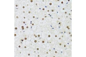 Immunohistochemistry of paraffin-embedded human liver using DDB1 Antibody (ABIN5971498) at dilution of 1/100 (40x lens). (DDB1 anticorps)