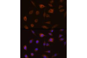 Immunofluorescence analysis of L929 cells using GSTT1 Rabbit pAb (ABIN3021870, ABIN3021871, ABIN3021872, ABIN1512971 and ABIN6216656) at dilution of 1:100 (40x lens).