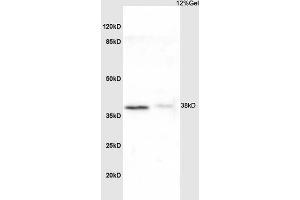 L1 rat liver lysate L2 mouse kidney lysates probed with Anti NDUFA8 Polyclonal Antibody, Unconjugated (ABIN751723) at 1:200 overnight at 4 °C. (NDUFA8 anticorps  (AA 101-172))