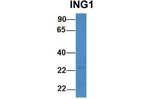 Host:  Rabbit  Target Name:  ING1  Sample Type:  Human 721_B  Antibody Dilution:  1. (ING1 anticorps  (N-Term))