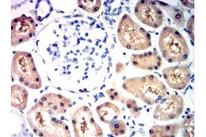 Immunohistochemical analysis of paraffin-embedded kidney tissues using HIF2a mouse mAb with DAB staining.