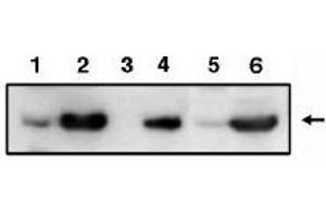 Image no. 1 for anti-Tumor Protein P53 Inducible Protein 3 (TP53I3) antibody (ABIN265005)