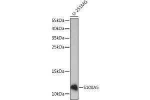 Western blot analysis of extracts of U-251MG cells, using S100 Rabbit pAb (ABIN7270126) at 1:1000 dilution. (S100A5 anticorps  (AA 1-92))
