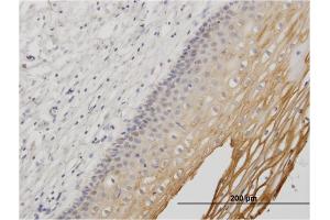 Immunoperoxidase of monoclonal antibody to MUC1 on formalin-fixed paraffin-embedded human uterine cervix.