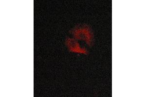 ABIN6268884 staining MCF-7 cells by ICC/IF.