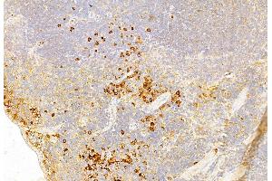 ABIN6261731 and ABIN6269136 at 1/100 staining Mouse spleen tissue by IHC-P. (FGFR1 anticorps  (C-Term))