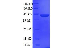SDS-PAGE (SDS) image for serine/arginine-Rich Splicing Factor 1 (SRSF1) (AA 2-248) protein (His-SUMO Tag) (ABIN5710356) (SRSF1 Protein (AA 2-248) (His-SUMO Tag))