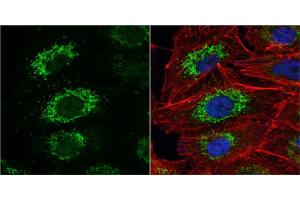 ICC/IF Image ALDH2 antibody detects ALDH2 protein at mitochondria by immunofluorescent analysis.