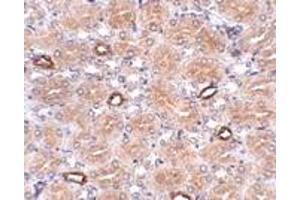 Immunohistochemistry (IHC) image for anti-Notum Pectinacetylesterase Homolog (NOTUM) (N-Term) antibody (ABIN1031488) (NOTUM anticorps  (N-Term))