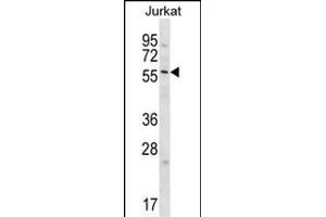 GPC3 Antibody  (cat (ABIN652202 and ABIN2840751)) western blot analysis in Jurkat cell line lysates (35 μg/lane). (Glypican 3 anticorps  (C-Term))