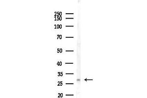 anti-RAB23, Member RAS Oncogene Family (RAB23) (C-Term) antibody