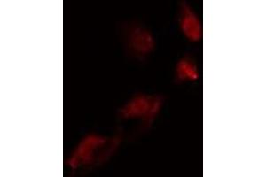 ABIN6275542 staining  COLO205 cells by IF/ICC. (TLK2 anticorps  (Internal Region))