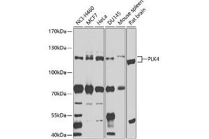 Western blot analysis of extracts of various cell lines, using PLK4 antibody (ABIN6132496, ABIN6145781, ABIN6145782 and ABIN6225196) at 1:1000 dilution. (PLK4 anticorps  (AA 641-970))