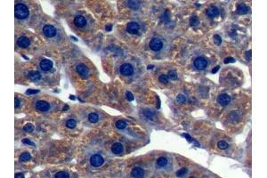 DAB staining on IHC-P; Samples: Rat Liver Tissue (LSS anticorps  (AA 101-250))