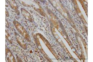 Immunoperoxidase of monoclonal antibody to GMPS on formalin-fixed paraffin-embedded human small Intestine.