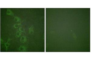 Immunofluorescence analysis of HuvEc cells, using Histamine H1 Receptor (Phospho-Ser398) antibody. (HRH1 anticorps  (pSer398))