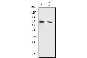 Western blot analysis of MMP2 using anti-MMP2 antibody (ABIN7601677).