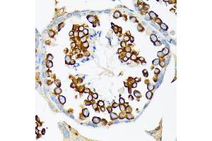 Immunohistochemistry of paraffin-embedded mouse testis using Calmegin Rabbit mAb (ABIN7266026) at dilution of 1:100 (40x lens).