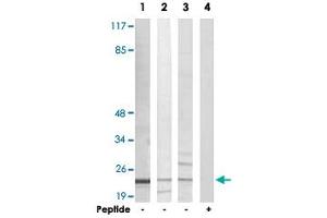 Western blot analysis of extracts from Jurkat cells (Lane 1 and lane 4), K-562 cells (Lane 2) and HUVEC cells (Lane 3), using AKAP14 polyclonal antibody . (AKAP14 anticorps)