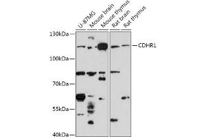 anti-Protocadherin 21 (PCDH24) (AA 20-300) antibody