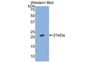 Western Blotting (WB) image for anti-Inter alpha Globulin Inhibitor H5 (ITIH5) (AA 569-737) antibody (ABIN1859514)