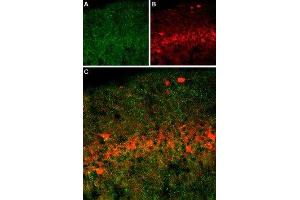 Expression of SERT in rat brain - Immunohistochemical staining of immersion-fixed, free floating rat brain frozen sections using Anti-Serotonin Transporter (SERT) (extracellular) Antibody (ABIN7043745, ABIN7044608 and ABIN7044609), (1:400). (SLC6A4 anticorps  (4th Extracellular Loop))