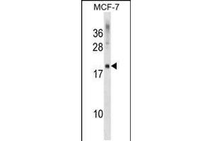 Western blot analysis in MCF-7 cell line lysates (35ug/lane). (CMTM5 anticorps  (AA 62-88))