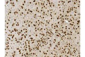 IHC analysis of NOVA2 using anti-NOVA2 antibody (ABIN7599078). (NOVA2 anticorps  (AA 1-205))