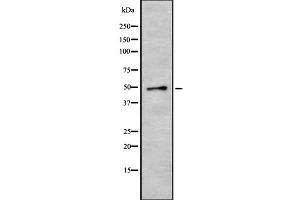 Western blot analysis of CRLF3 using HeLa whole cell lysates (CRLF3 anticorps  (Internal Region))